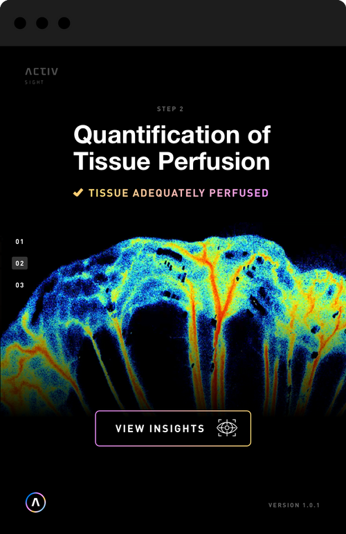 Quntification of Tissue Perfusion