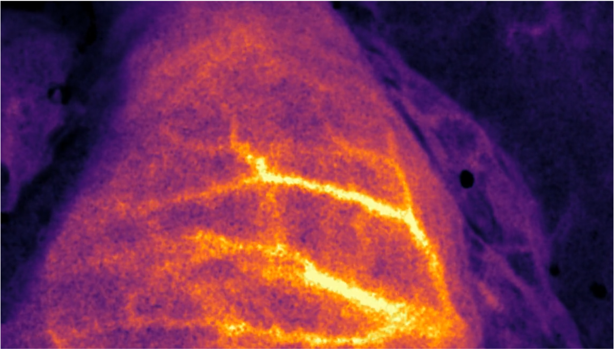 Activ Perfusion imaging